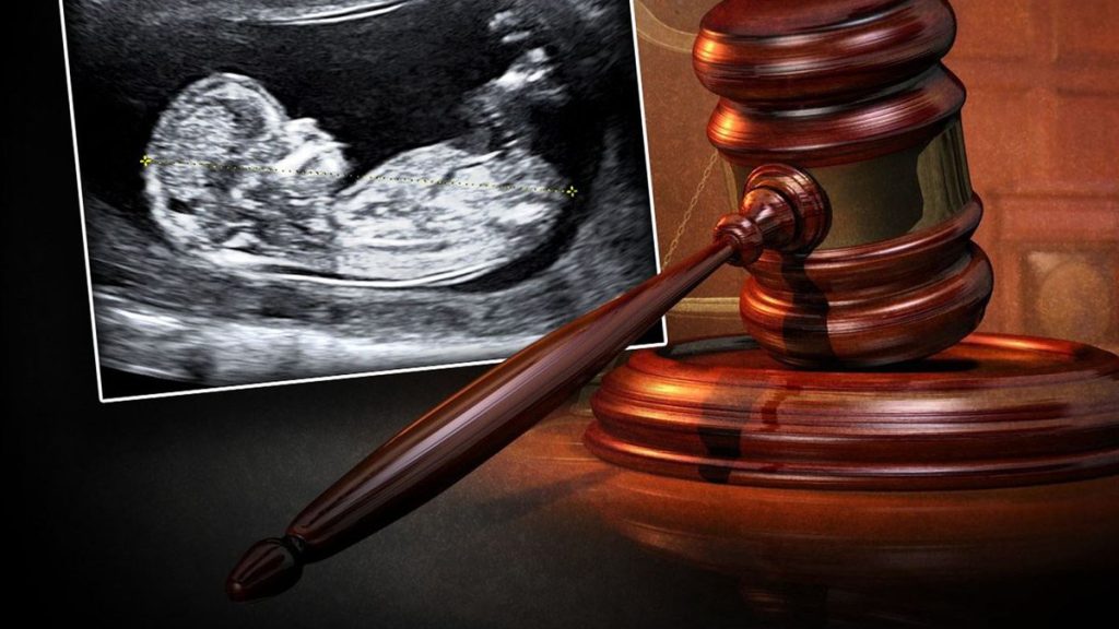 Florida Abortion Laws: Abortion Care And Your Legal Rights.