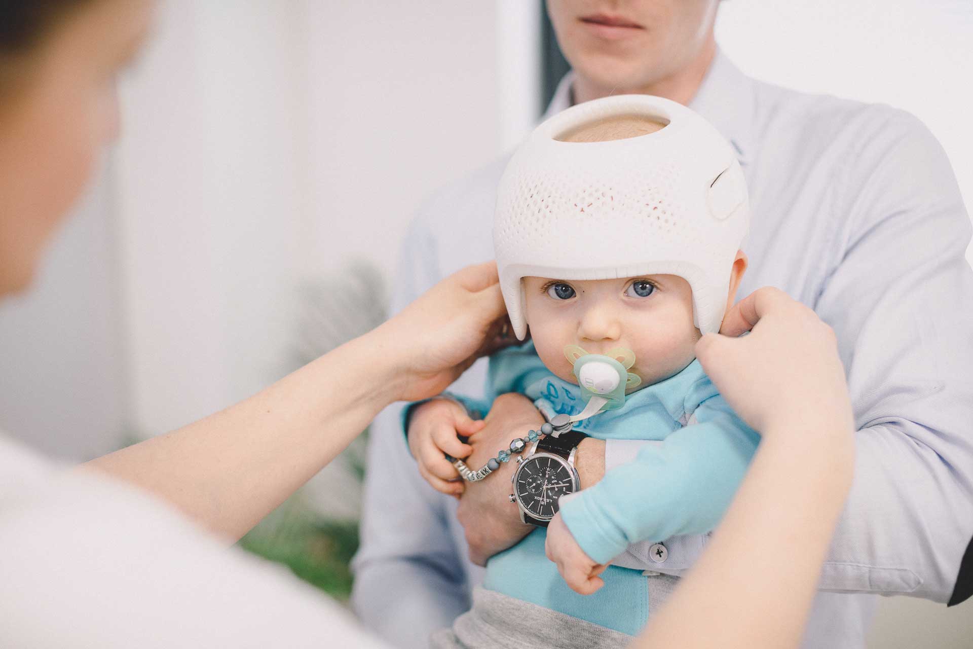 Plagiocephaly In Babies | Tips To Avoid Flat Head Syndrome.